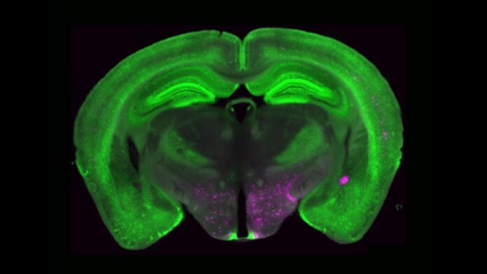 Fluorescent imaging of NPY+ neurons (green) throughout the brain are shown in addition to neurons in magenta that send projections to the PBN.