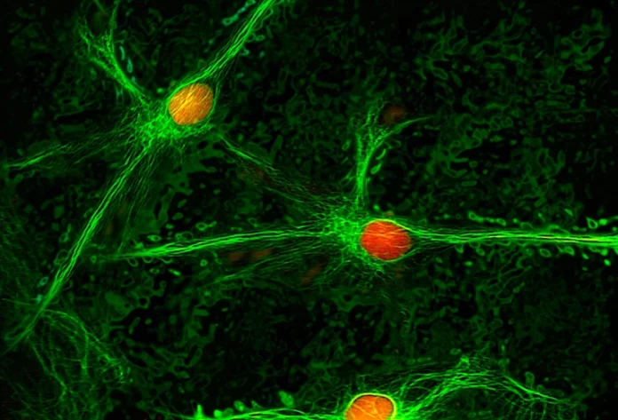 Neurons (pictured) in a brain region called the parabrachial nucleus have been implicated in creating the sensation of pain that persists long after an initial injury.