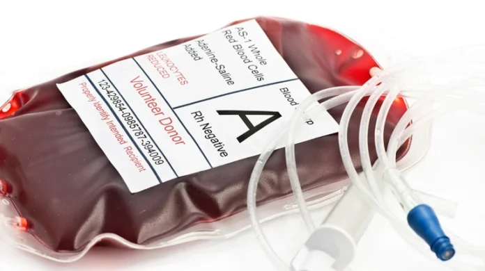 esearchers converted a kidney with type-A blood to type-